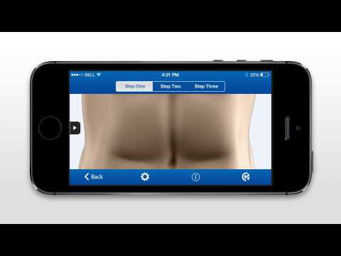 Pneumoperitoneum in humans Video