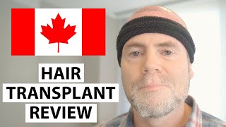 Hair Transplant Patient Review: Hello Canada! Ross's Hair Transplant Experience at AEK Hair Clinic