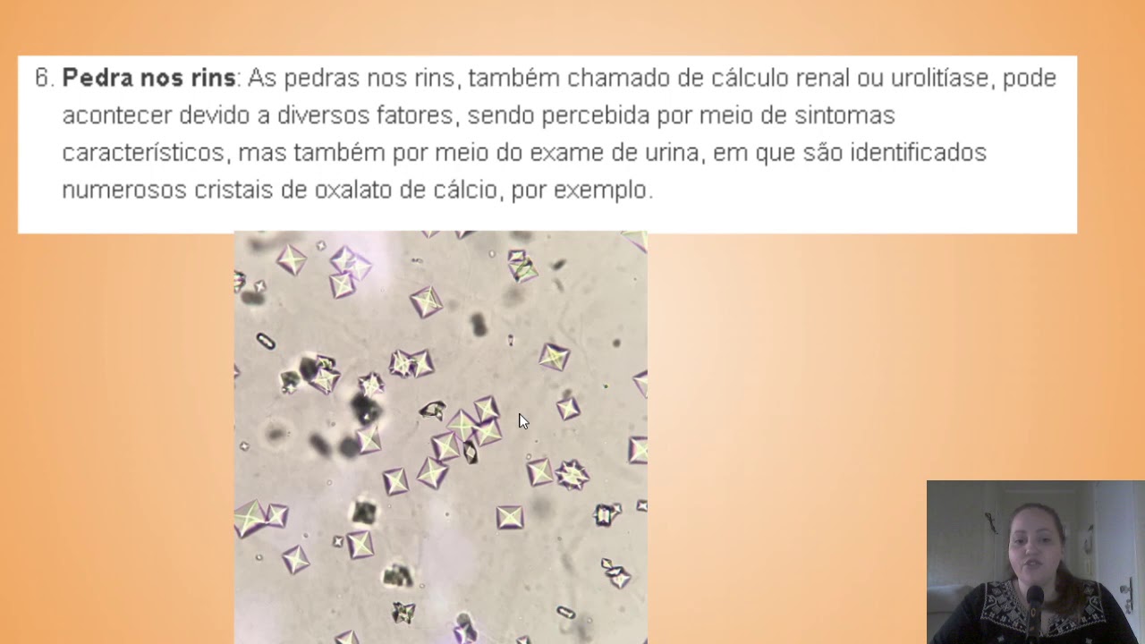 Sedimentoscopia: Cristais, Muco e Flora Bacteriana.