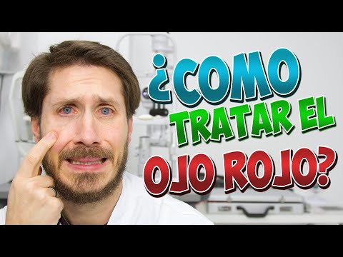 🔴 OJO ROJO ¿como puedo tratarlo?