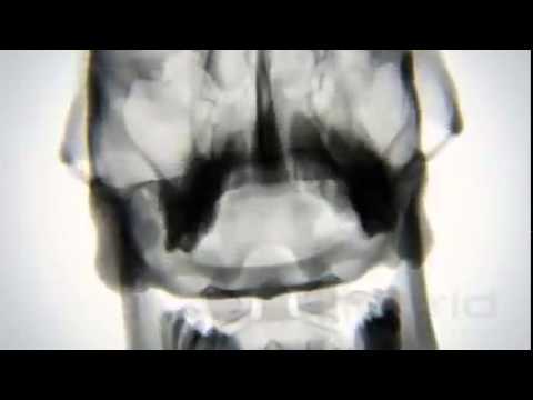 X ray Body in Motion   Yoga