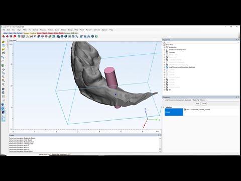 implant designing materialase 3matic lesson (5)