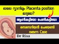 Baby Gender Prediction Using Scan Report |Placental Position