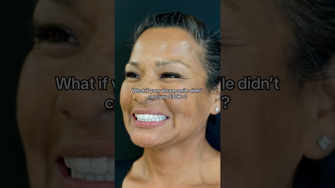 Affordable All-on-4® Dental Implants | Starting at $11K Per Arch 🦷 #dentalimplants #toothless