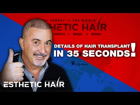 Details of Hair transplant in just 35 seconds!