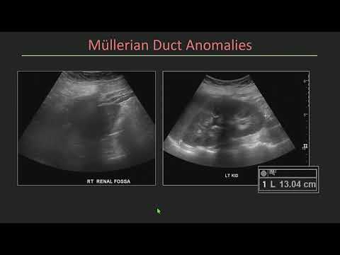 Gynecology and Obstetrics Ultrasound
