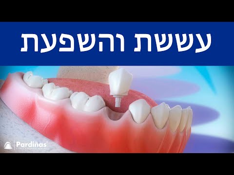 © מִיָדִי שתלים