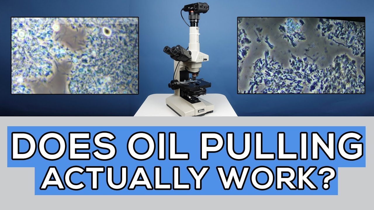 Oil Pulling for 35 Days: Did It Cure Gum Disease Microscope Analysis🔬