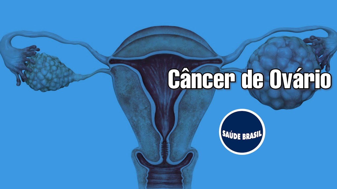 Larissa Müller Gomes-1