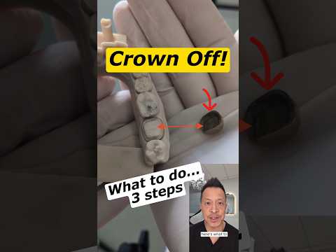Dental Crown Fell Out While Eating? Here’s What You Should Do! #dentallan #dentist #shorts
