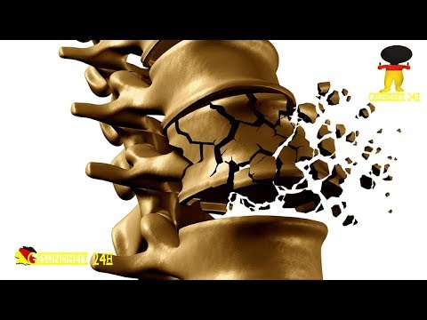 Der Schmerz und der Spin-Clip Betäubungscreme mit Osteochondrose