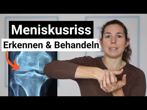 Meniskusriss - Alles was du wissen musst (Verletzung, OP, Reha)