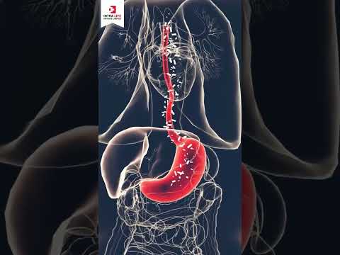 Vonoprazan Tablet 20 & 10 Mg
