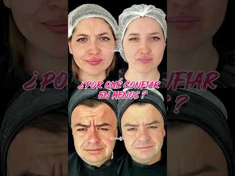 Botox en Clínica Biomedic