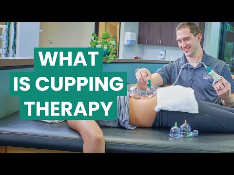 What is Cupping Therapy? Types, Benefits, and Treatment | Foothills Sports Medicine Physical Therapy