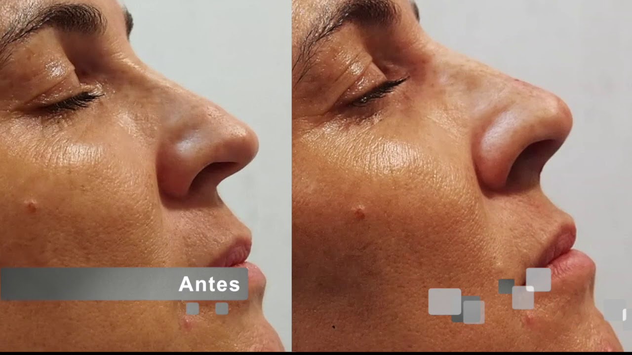 Alberto Candau Álvarez-51