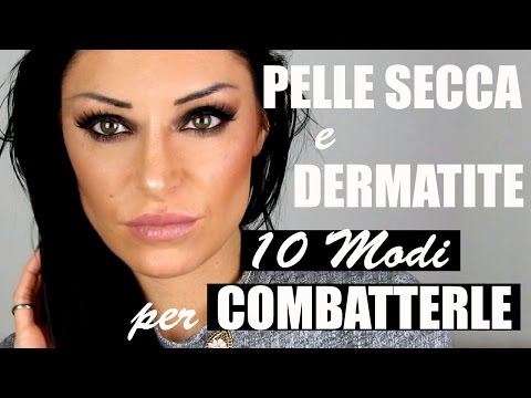 Quello che è la psoriasi di malattia Su eczema stupnyakh