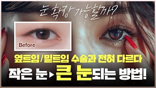 성형수술 할 때 아무곳이나 가면 안되는 이유 | 눈수술, 코수술 수술후케어 | 노엘의원 염해천 대표원장