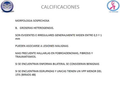 que significa prostata heterogenea con calcificaciones que significa prostata heterogenea con calcificaciones