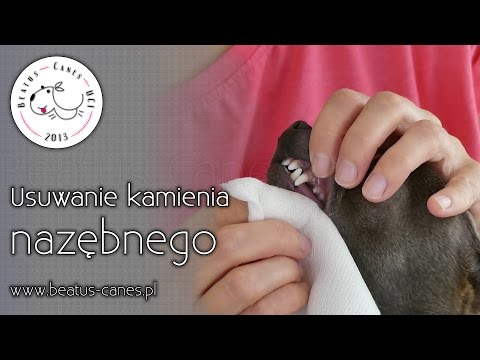 Kości nóg gimnastyki Kości na nogi koślawe zniekształcenie stóp