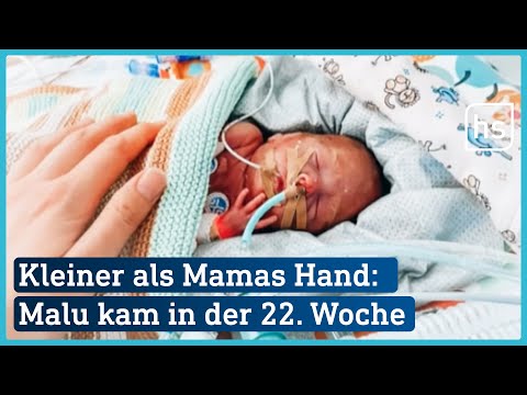Extrem-Frühchen Malu (22. SSW): So geht es ihm mit 4 Monaten | hessenschau