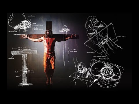 Suferința Și Răstignirea lui Isus🔴 Un Medic Analizează Răstignirea ! Hristos A Inviat !