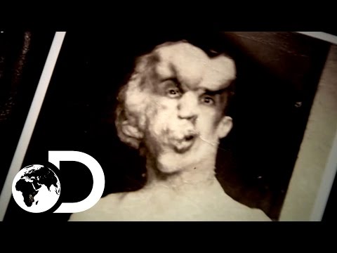 Learning How Merrick Walked, Talked And Died | Meet The Elephant Man