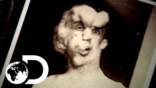Learning How Merrick Walked, Talked And Died | Meet The Elephant Man