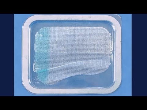 Progripᵀᴹ Laparoscopic Self Fixating Anatomical Mesh - Folding Demonstration