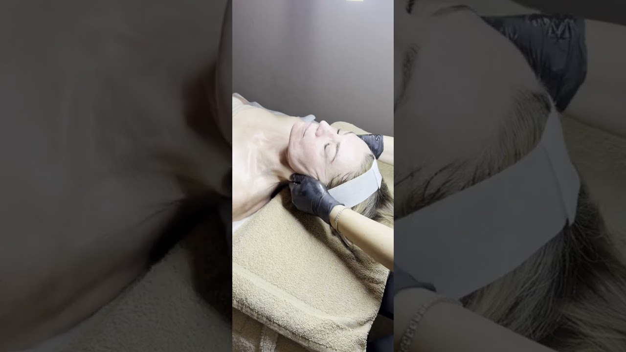Non Surgical Facelift Facial