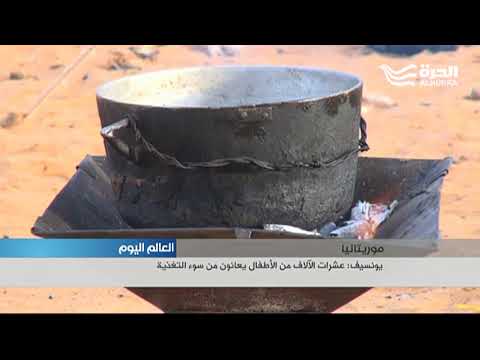 يونيسف: عشرات الآلاف الأطفال في موريتانيا يعانون من سوء التغذية