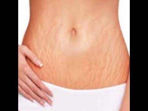Bagaimana untuk menyingkirkan perut bir di laki-laki rumah cepat Dr Pierre Ducane diet dalam buku, saya tidak bisa menurunkan berat badan