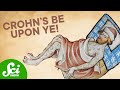 Have An Autoimmune Disease Blame The Black Death