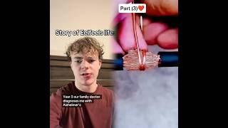 Download lagu Just noticed I call myself eel now too #joke #skit #sketchcomedy #eelfeel #sketch #viral #fyp mp3 Download lagu Just noticed I call myself eel now too #joke #skit #sketchcomedy #eelfeel #sketch #viral #fyp mp3