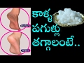 కాళ్ళ పగుళ్ళు తగ్గాలంటే I Cracked Feet I Cracked Heels I M