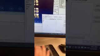 Creating a notes template in Dentrix #dental #dentalhygiene #dentaltips #dentalhygienist