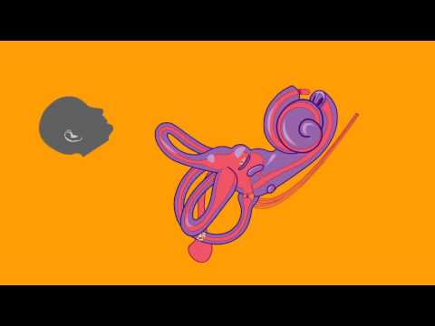 Understand BPPV in One Minute - Michael Teixido, M.D.