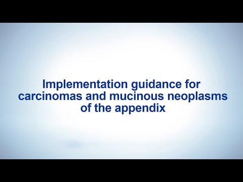Implementation guidance for carcinomas and mucinous neoplasms of the appendix