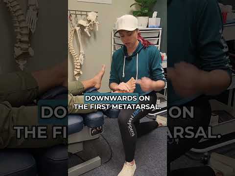 Do You Really Have Hallux Rigidus?