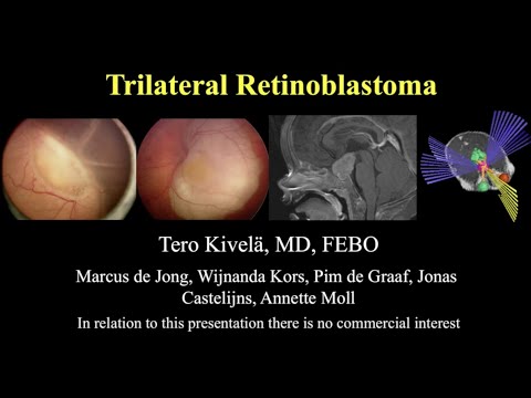 Retinoblastoma: Trilateral Retinoblastoma - Dr. Tero Kivela