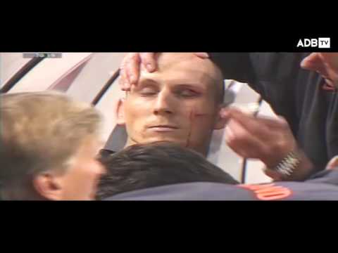 Jaap Stam eyebrow injury