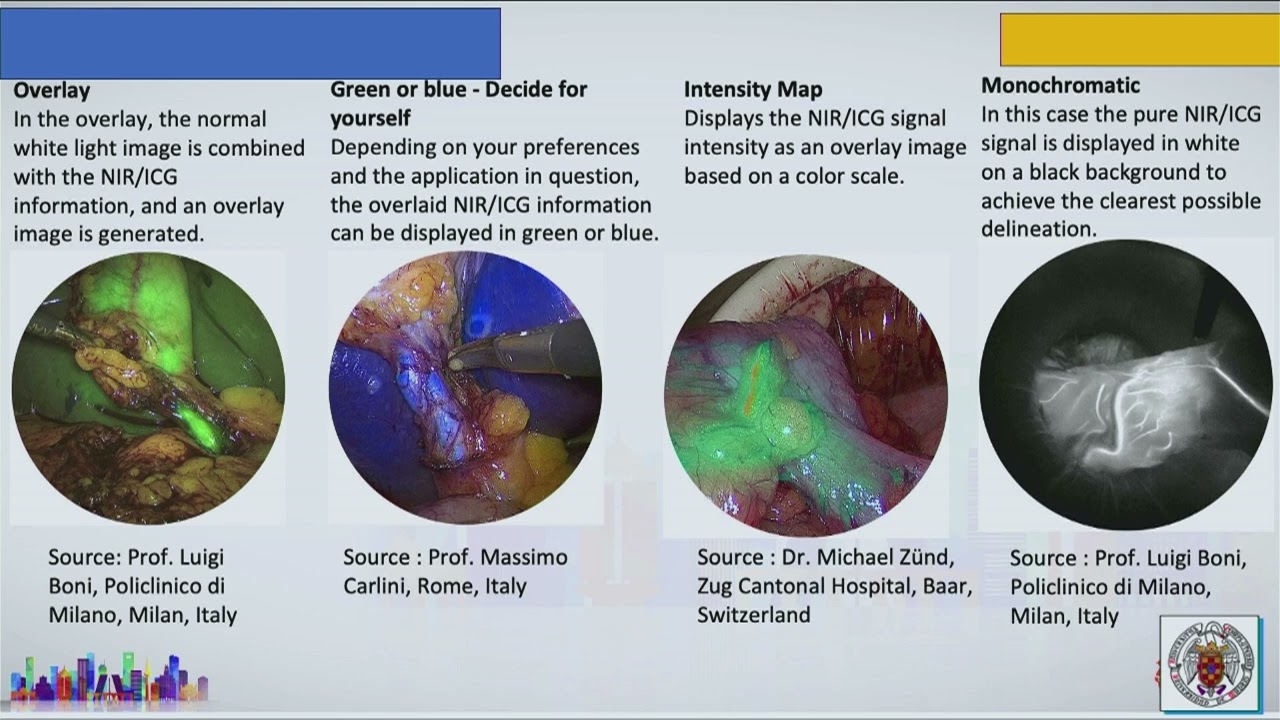 SADI-S / Dr Antonio Torres