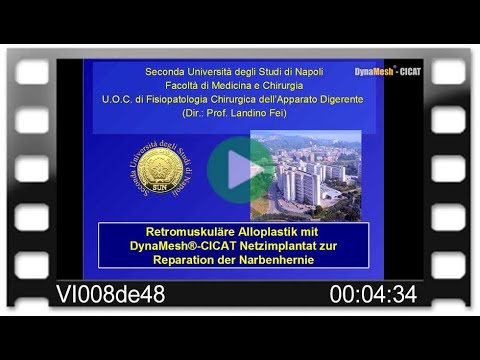 DynaMesh®-CICAT - OP-Video: Retromuskuläre Alloplastik - Reparation der Narbenhernie