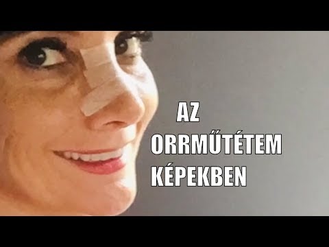 segítsen a papaya a fogyásban