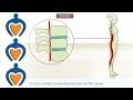 Sciatica What Is It And How Is It Treated