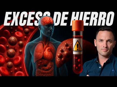 Excess Iron Damages Your Body | These Are the Symptoms (High Ferritin)
