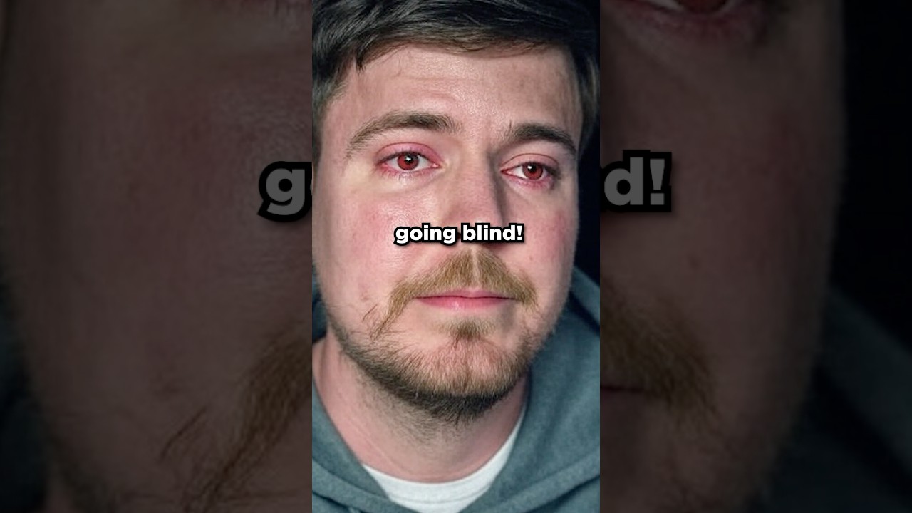 We Saved MrBeast From Going BLIND 😱