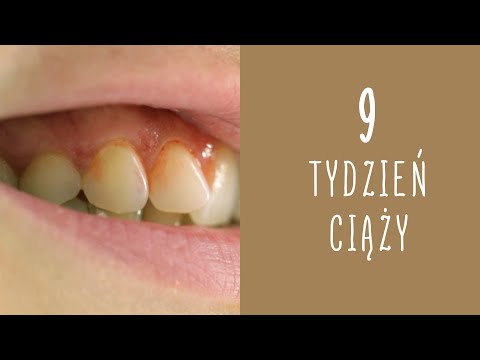 9 tydzień ciąży