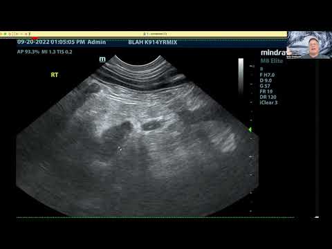 The Cost of Missing a Lesion [5 Sono-Minutes with SonoPath Ep.5]