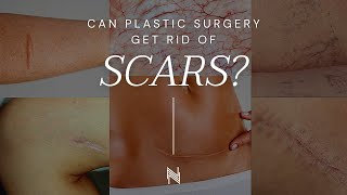 Is it Possible to Get Rid of Scars with Plastic Surgery?